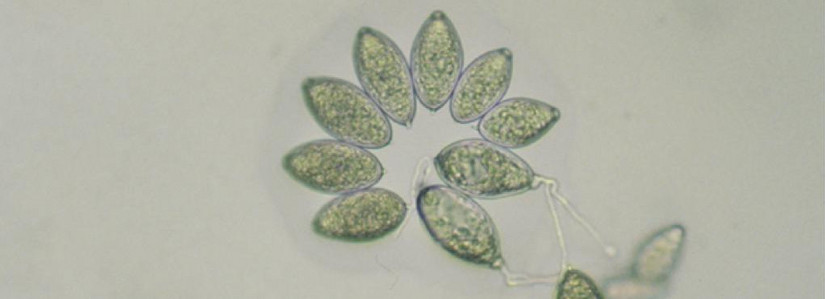 Bild: Sporen von Phytophthora ramorum
